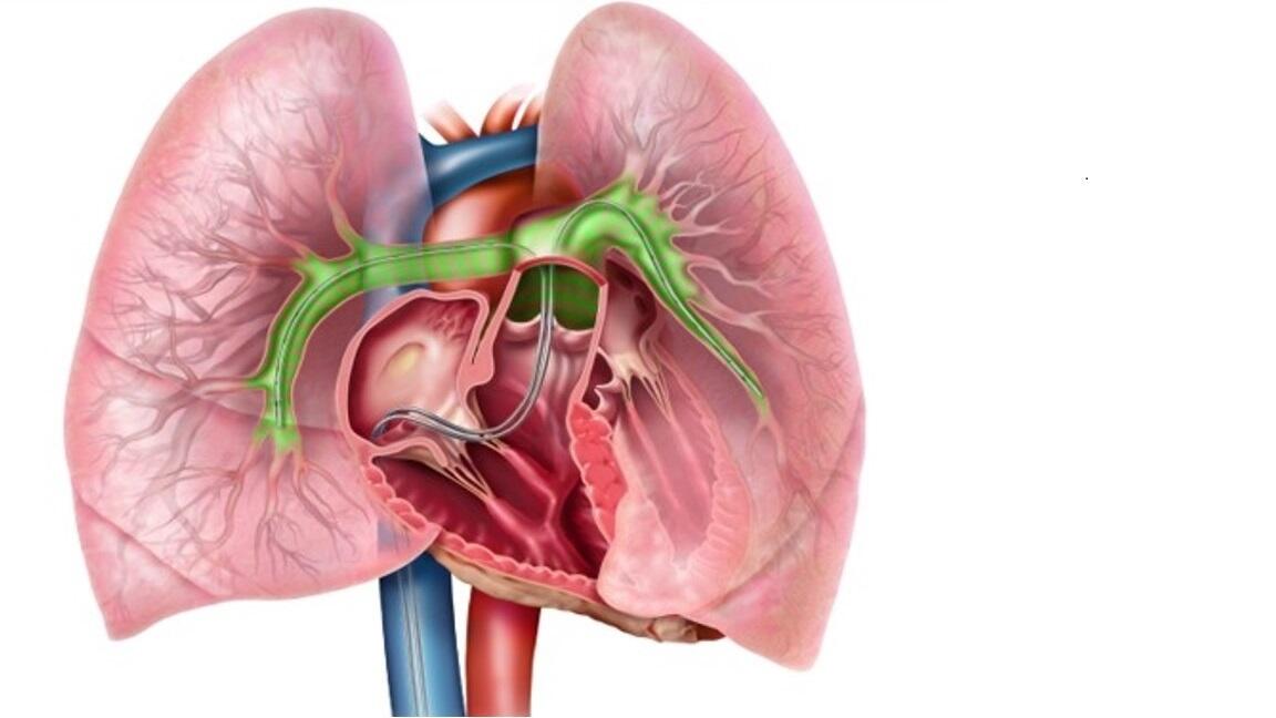 Herz_Boston Scietific Corp.